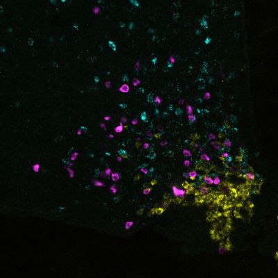 There are several types of cells in the hypothalamus that regulate our energy uptake (yellow: the AgRP cells Jens Brüning studied, magenta: so-called POMC cells, cyan: PNOC-expressing cells). © Max Planck Institute for Metabolism Research, Cologne