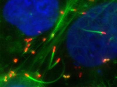 Mammalian cells infected by Listeria: Listeria (red) signal infected cells to form comet-like tails from actin (green) that push them through their host cells (blue = cell nuclei). © Pascale Cossart